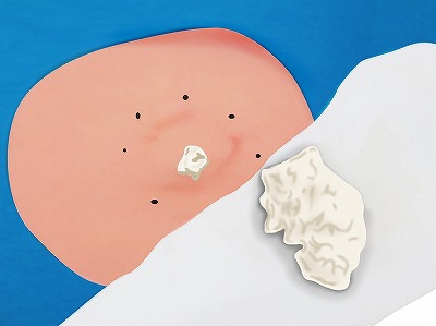 くり抜き法 手順5