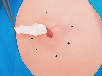 くり抜き法 手順8